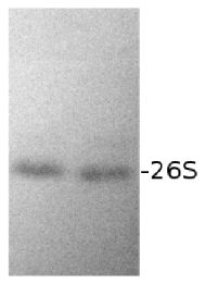 DS5a | Drosophila 26S proteasome subunit Rpn10 in the group Antibodies Plant/Algal / Protein Modifications / Plant Proteasome at Agrisera AB (Antibodies for research) (AS01 012)